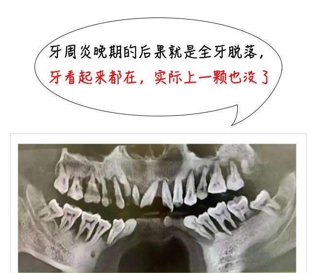 “洗完牙后，我的牙缝变大、牙齿松了！”医生终于忍不住说出实话……